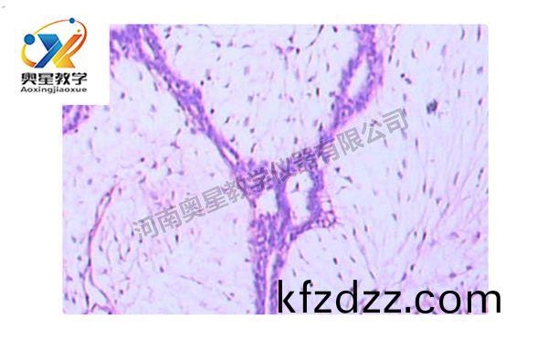 乳(ru)腺(xian)纖維(wei)腺(xian)癅(liu)