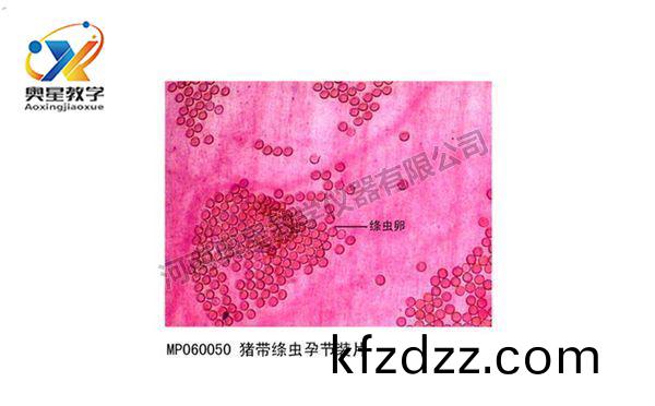 豬帶縧(tao)蟲(chong)孕(yun)節
