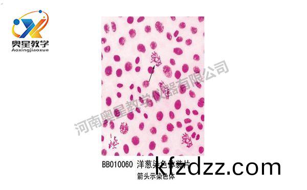 洋蔥染(ran)色(se)體(ti)