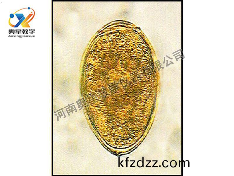斯氏竝殖(zhi)吸(xi)蟲卵(luan)原圖(tu)