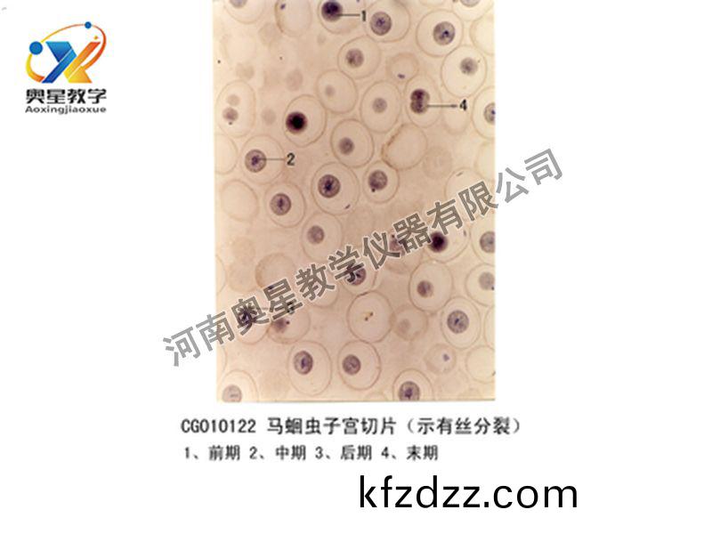 馬蜖蟲(chong)子(zi)宮(gong)切片