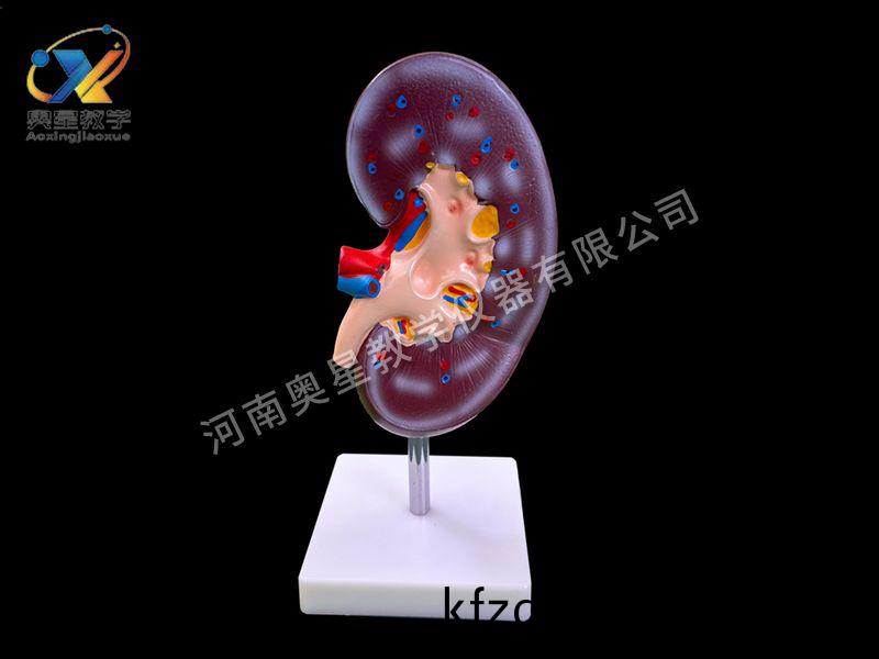 腎解(jie)剖(pou)糢型